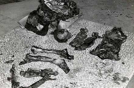Remains of torso murderer victim, 1938